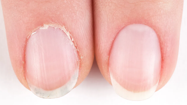 The Importance of Cuticle Care