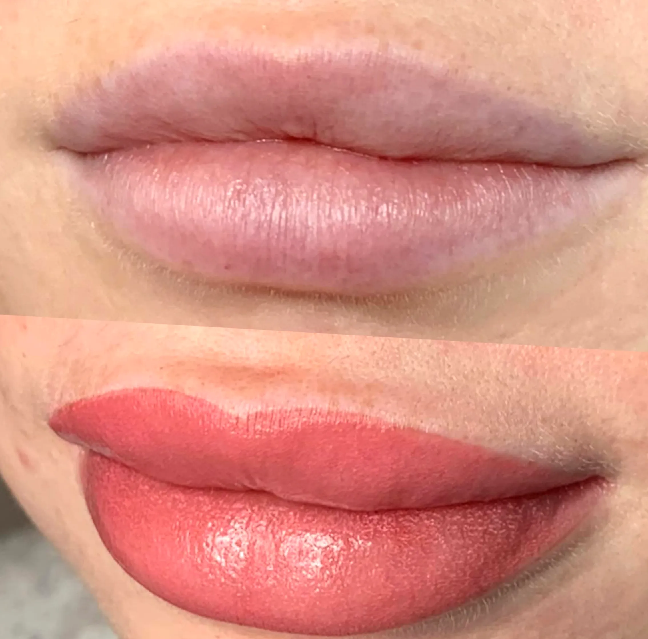 pigment migration fix